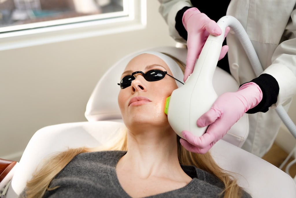 IPL Photo Facial treatment showing light-based skin rejuvenation technology